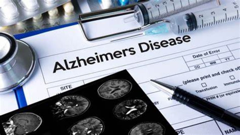 Alzheimer ah eejaadh kuri furathama beyhah huhdha dheefi